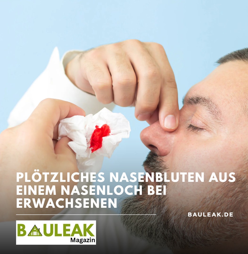 Plötzliches Nasenbluten aus einem Nasenloch bei Erwachsenen Plötzliches Nasenbluten aus einem Nasenloch bei Erwachsenen